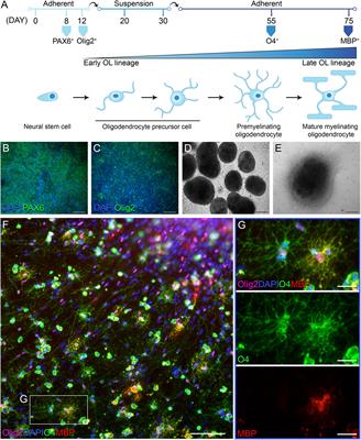 Transcriptional abnormalities in induced pluripotent stem cell-derived oligodendrocytes of individuals with primary progressive multiple sclerosis